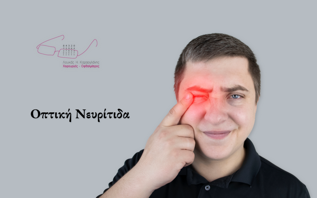 Οπτική Νευρίτιδα – Όσα χρειάζεται να γνωρίζετε